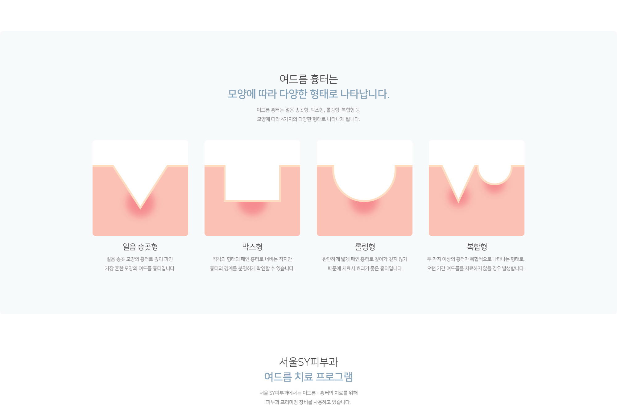 여드름, 모공, 흉터